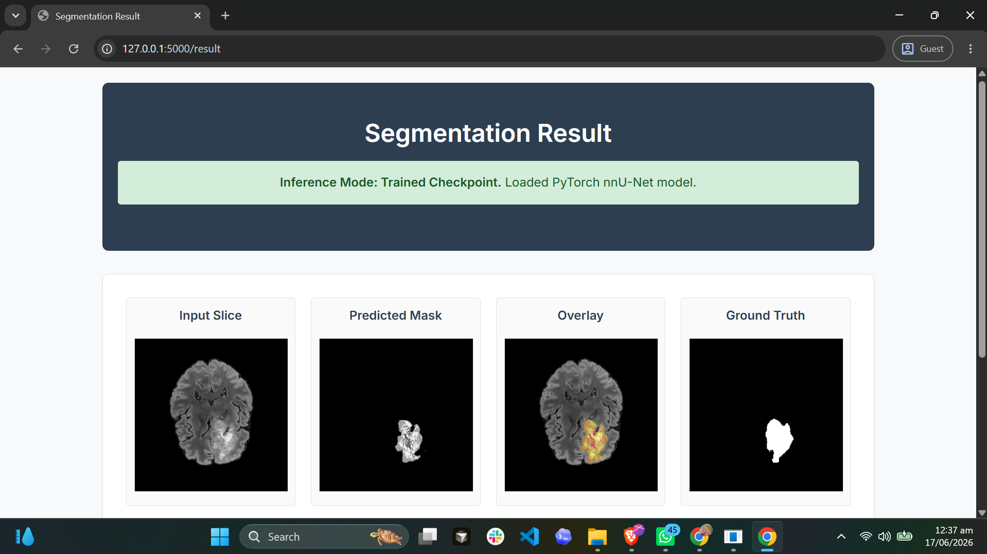 DeepNeuro: Real-time Multi-modal Brain Tumor Segmentation using nnU-Net